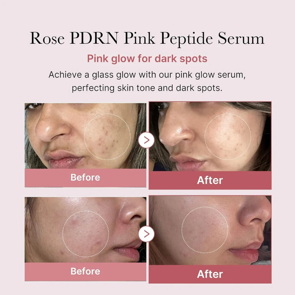 PDRN PINK PEPTIDE SERUM